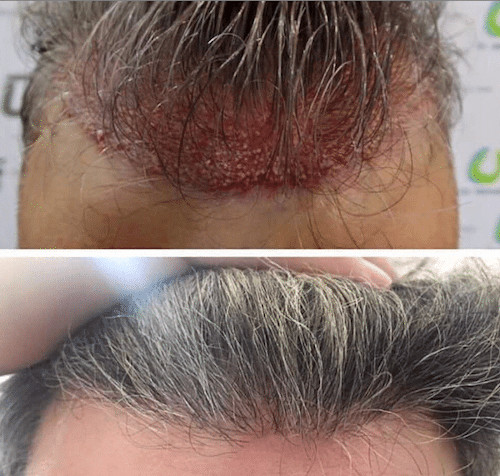 NON-Shave